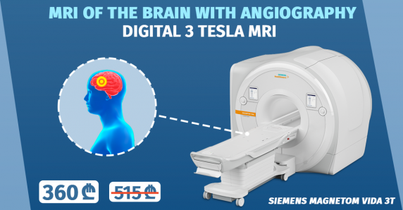 МРТ исследование головного мозга с ангиографией + бесплатная консультация невролога